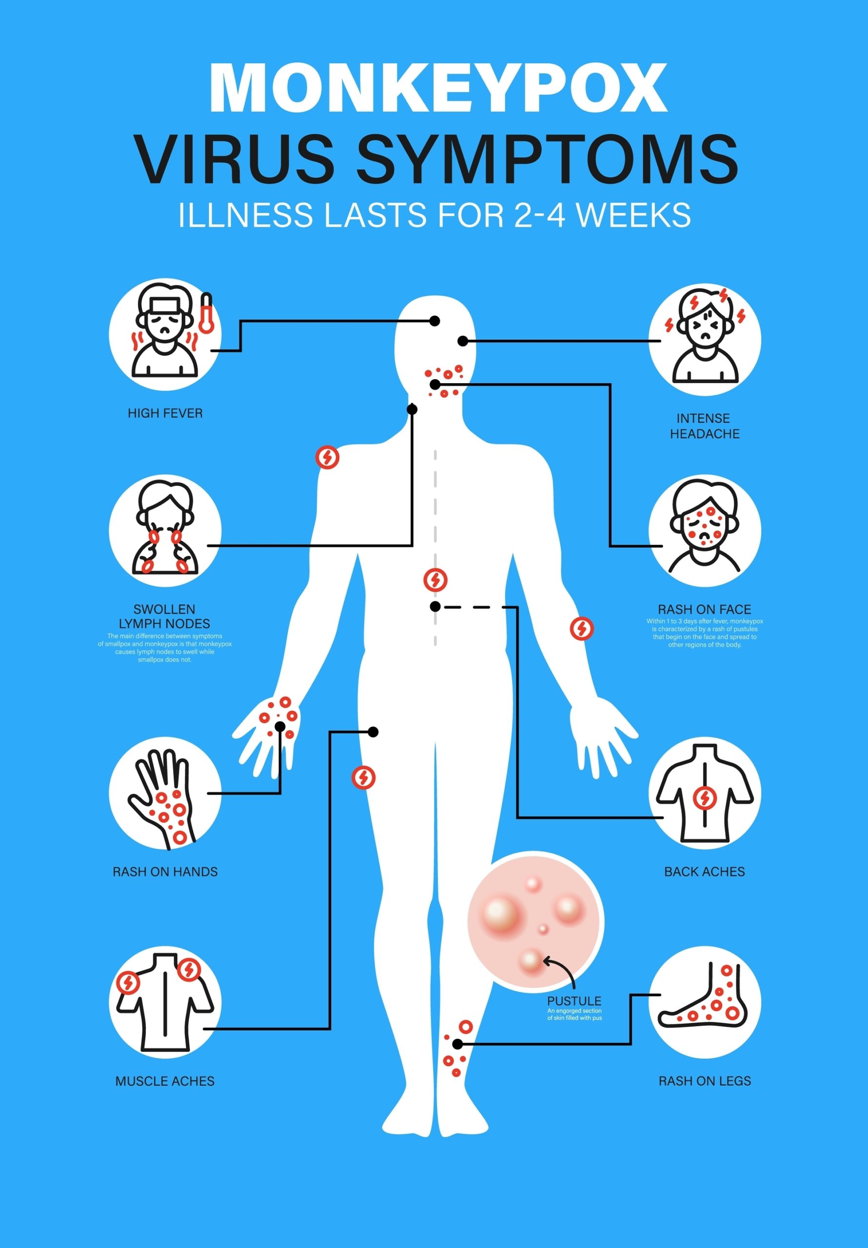 What Is Monkeypox: Symptoms, Pictures, and Treatment